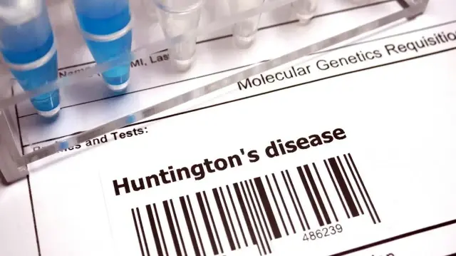 huntington hastaliginda tarihi gelisme yeni tedavi yuzde 75 yavaslatiyor lxarOTEg