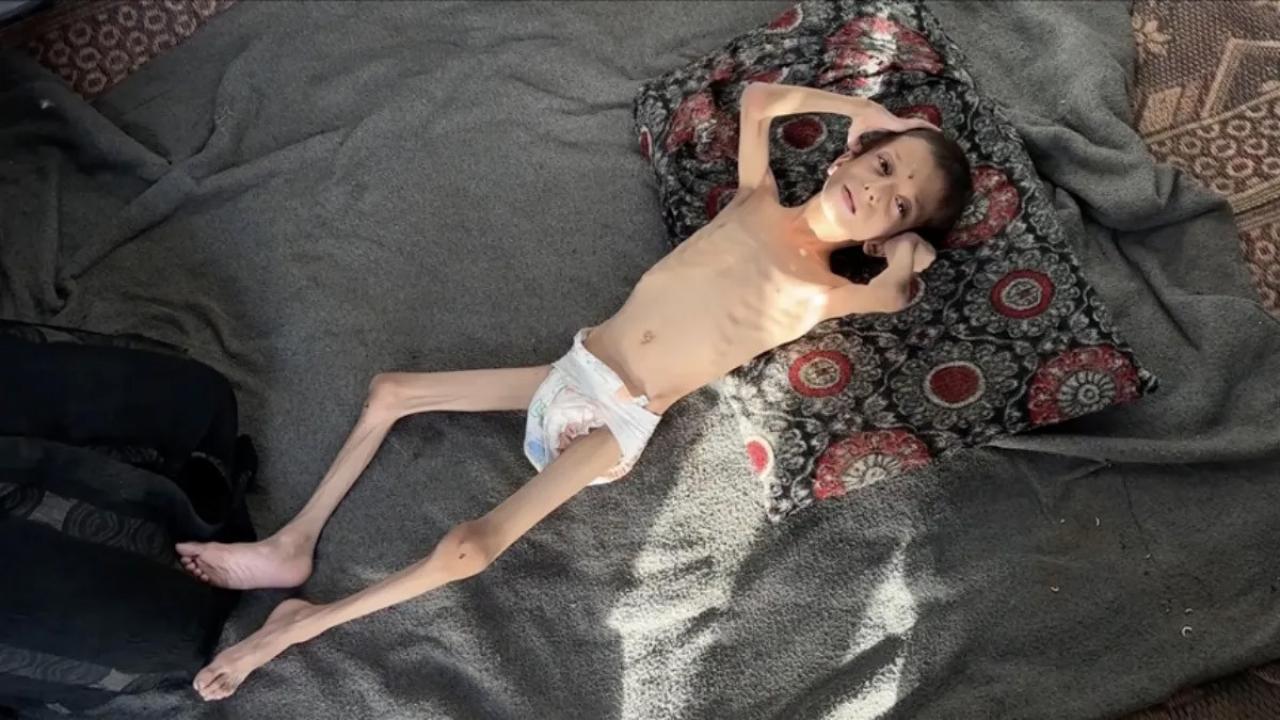 10 yasindaki gazzeli nafiz 4 aylik bebege donustu annesi tasimaya bile korkuyor BPG7wlax